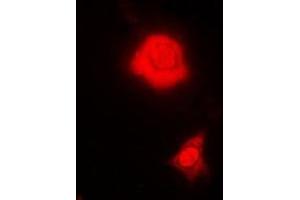 Immunofluorescent analysis of RBFOX3 staining in MCF7 cells. (NeuN Antikörper)