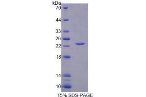 Image no. 1 for Interleukin 1 alpha (IL1A) (AA 98-271) protein (His tag) (ABIN6238523) (IL1A Protein (AA 98-271) (His tag))