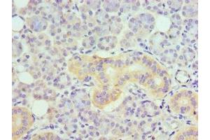 Immunohistochemistry of paraffin-embedded human pancreatic tissue using ABIN7173876 at dilution of 1:100 (TNFRSF21 Antikörper  (AA 371-655))