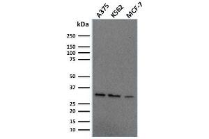 Western Blot Analysis of Human A375, K562, MCF-7 cell lysate using Replication Protein A2 Mouse Monoclonal Antibody (RPA2/2106). (RPA2 Antikörper)