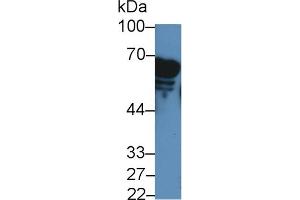 Detection of AMY2A in Rat Serum using Polyclonal Antibody to Amylase, Alpha 2A (AMY2A)