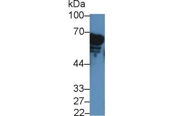 AMY2A Antikörper  (AA 201-473)