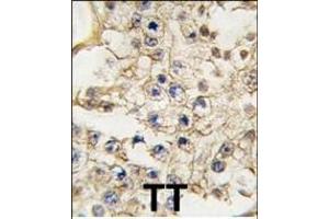 Formalin-fixed and paraffin-embedded human testis tissue reacted with EPHA10 antibody (N-term), which was peroxidase-conjugated to the secondary antibody, followed by DAB staining. (EPH Receptor A10 Antikörper  (N-Term))