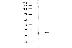 anti-Mitochondrial Ribosomal Protein L4 (MRPL4) (Internal Region) antibody