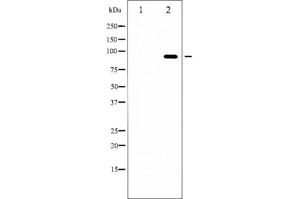 FOXO3 Antikörper  (pSer253)