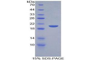 SDS-PAGE (SDS) image for Secretory Leukocyte Peptidase Inhibitor (SLPI) (AA 20-131) protein (His tag) (ABIN1171326)