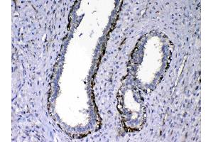 Immunohistochemistry (IHC) image for anti-Nephroblastoma Overexpressed (NOV) (AA 334-357), (C-Term) antibody (ABIN5518938)