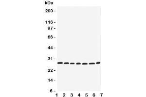 Western blot testing of EIF6 antbody; Lane 1: rat liver;  2: (r) kidney;  3: human COLO320;  4: (h) SW620;  5: (h) HeLa;  6: (h) 293T;  7: mouse HEPA cell lysate. (EIF6 Antikörper  (Middle Region))