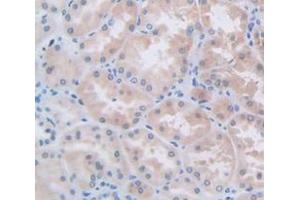 IHC-P analysis of Human Tissue, with DAB staining. (L1CAM Antikörper  (AA 218-423))