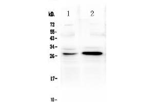 Western blot analysis of TNFRSF18 using anti-TNFRSF18 antibody . (TNFRSF18 Antikörper  (AA 178-241))