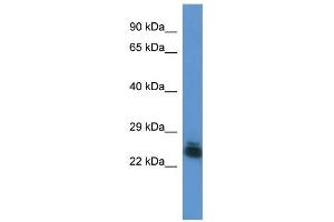 Western Blot showing FYTTD1 antibody used at a concentration of 1. (FYTTD1 Antikörper  (Middle Region))