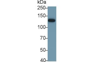 Detection of ITGaV in Mouse Stomach lysate using Polyclonal Antibody to Integrin Alpha V (ITGaV) (CD51 Antikörper  (AA 71-322))