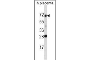 Western blot analysis in human placenta tissue lysates (35ug/lane). (SPINT1 Antikörper  (AA 178-207))
