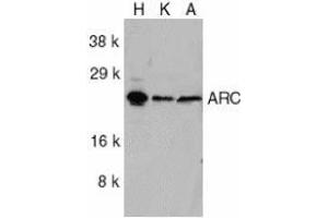 Western blot analysis of ARC in HeLa (H), KB (K), and A549 (A) whole cell lysates with AP30076PU-N ARC antibody at 1/1000 dilution. (NOL3 Antikörper  (C-Term))