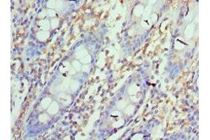 Immunohistochemistry of paraffin-embedded human colon tissue using ABIN7164673at dilution of 1:100 (PD-L1 Antikörper  (AA 19-238))