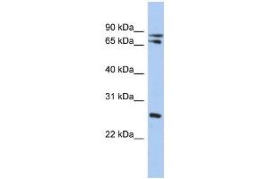WB Suggested Anti-OVOL2 Antibody Titration: 0. (OVOL2 Antikörper  (Middle Region))