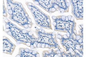 PERK Mouse monoclonal Antibody at 1/100 staining Rat kidney tissue by IHC-P.