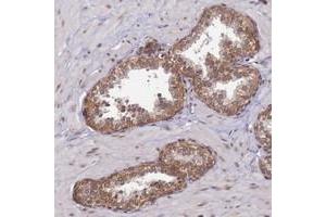 Immunohistochemical staining of human prostate with CCDC9 polyclonal antibody  shows moderate cytoplasmic positivity in glandular cells. (CCDC9 Antikörper)