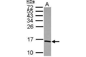 Western Blotting (WB) image for anti-NADH Dehydrogenase (Ubiquinone) Fe-S Protein 5, 15kDa (NADH-Coenzyme Q Reductase) (NDUFS5) (Center) antibody (ABIN2855190)