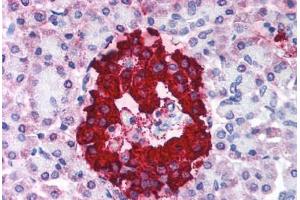 Human Pancreas (formalin-fixed, paraffin-embedded) stained with INS antibody ABIN214027 at 5 ug/ml followed by biotinylated anti-mouse IgG secondary antibody ABIN481714, alkaline phosphatase-streptavidin and chromogen. (Insulin Antikörper)