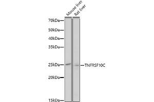 Western blot analysis of extracts of various cell lines, using TNFRSF10C antibody (ABIN3021517, ABIN3021518, ABIN3021519 and ABIN6215183) at 1:1000 dilution. (DcR1 Antikörper  (AA 30-130))