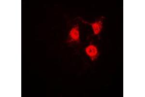 Immunofluorescent analysis of CDK2 staining in Jurkat cells. (CDK2 Antikörper  (C-Term))