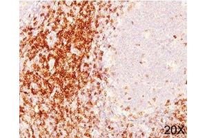 IHC testing of human tonsil (20X) stained with CD6 antibody cocktail (C6/372 + 3F7B5). (CD6 Antikörper)