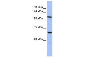 WB Suggested Anti-ZFPM1 Antibody Titration:  0. (ZFPM1 Antikörper  (Middle Region))