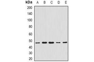 Western blot analysis of CCBL1 expression in Hela (A), A549 (B), mouse liver (C), mouse heart (D), rat kidney (E) whole cell lysates. (CCBL1 Antikörper)