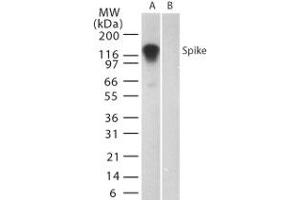 Image no. 1 for anti-SARS-Coronavirus Spike Protein (SARS-CoV S) (AA 19-35) antibody (ABIN199988) (SARS-CoV Spike Antikörper  (AA 19-35))