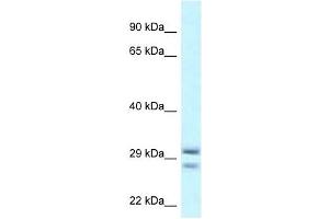 Western Blot showing RIT1 antibody used at a concentration of 1 ug/ml against THP-1 Cell Lysate (RIT1 Antikörper  (Middle Region))
