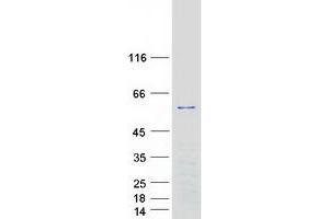 Validation with Western Blot