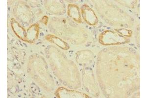 Immunohistochemistry of paraffin-embedded human kidney tissue using ABIN7175037 at dilution of 1:100 (C2ORF76 Antikörper  (AA 1-126))