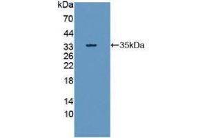 Western blot analysis of recombinant Human RIPK1. (RIPK1 Antikörper  (AA 17-289))