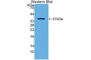 Western Blotting (WB) image for anti-Induced Myeloid Leukemia Cell Differentiation Protein Mcl-1 (MCL1) (AA 2-307) antibody (ABIN3205034) (MCL-1 Antikörper  (AA 2-307))
