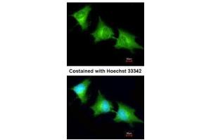 ICC/IF Image Immunofluorescence analysis of methanol-fixed HeLa, using SPR, antibody at 1:200 dilution. (SPR Antikörper)