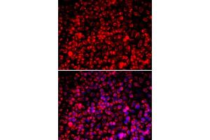 Immunofluorescence analysis of A549 cells using TOMM20 antibody. (TOMM20 Antikörper  (AA 20-145))