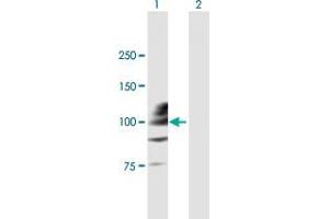 Lane 1: CC2D1A transfected lysate ( 104. (CC2D1A 293T Cell Transient Overexpression Lysate(Denatured))