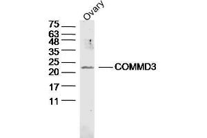 Mouse ovary lysates probed with COMMD3 Polyclonal Antibody, unconjugated  at 1:300 overnight at 4°C followed by a conjugated secondary antibody at 1:10000 for 90 minutes at 37°C. (COMMD3 Antikörper  (AA 101-195))