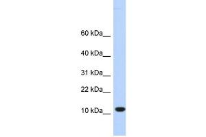 WB Suggested Anti-C10orf57 Antibody Titration:  0. (CJ057 Antikörper  (Middle Region))