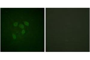 Immunofluorescence analysis of HeLa cells, using p53 (Acetyl-Lys317) Antibody. (p53 Antikörper  (acLys317))
