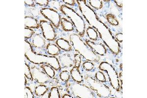 Immunohistochemistry (IHC) image for anti-Hepatocyte Growth Factor (Hepapoietin A, Scatter Factor) (HGF) (AA 30-285) antibody (ABIN3021683)