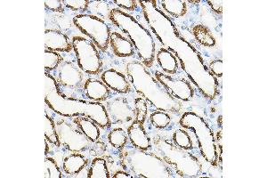 Immunohistochemistry of paraffin-embedded rat kidney using HGF Rabbit pAb (ABIN3021682, ABIN3021683, ABIN3021684 and ABIN6215504) at dilution of 1:100 (40x lens).