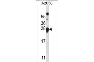 TMED9 Antibody (C-term) (ABIN657174 and ABIN2846305) western blot analysis in  cell line lysates (35 μg/lane).