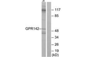 Western blot analysis of extracts from Jurkat cells, using GPR142 Antibody.