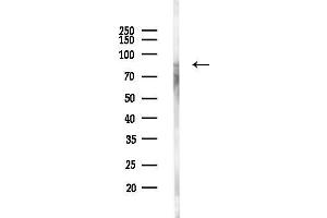 anti-Glycogen Synthase (GYS) (C-Term) antibody