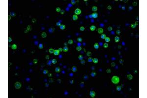Immunofluorescence (IF) image for anti-Complement Component (3d/Epstein Barr Virus) Receptor 2 (CR2) antibody (ABIN7127277)