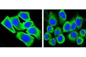 Confocal immunofluorescence analysis of methanol-fixed HepG2 (left) and Hela (right) cells using GAPDH mouse mAb (green), showing cytoplasmic localization. (GAPDH Antikörper)
