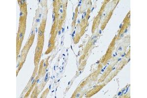 Immunohistochemistry (Paraffin-embedded Sections) (IHC (p)) image for anti-Ganglioside-Induced Differentiation-Associated Protein 1 (GDAP1) antibody (ABIN7262477)