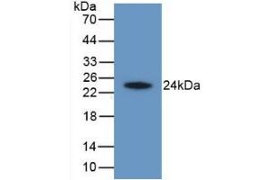 Detection of Recombinant HAVCR2, Human using Monoclonal Antibody to Hepatitis A Virus Cellular Receptor 2 (HAVCR2) (TIM3 Antikörper  (AA 22-202))